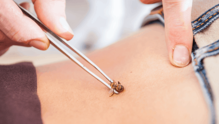 Arı Zehrinde Saklı Şifasında Bilinen 5 Özellik