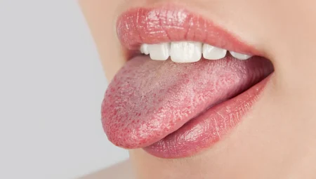 Dil Renginiz Sağlığınızı Ele Veriyor: Bilmeniz Gerekenler