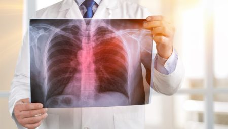 Akciğer Kanserinin En Sinsi 9 Belirtisi